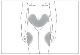 Показання філграстим-віста