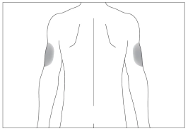 Лікарський засіб філграстим-віста