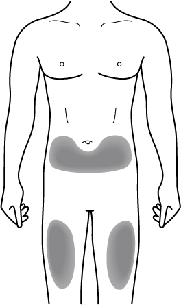 Показання хайрімоз