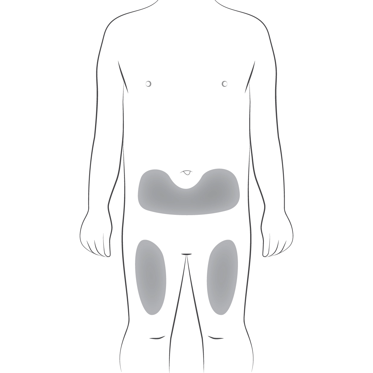 Схема хайрімоз