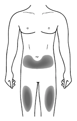 Показання ксолар
