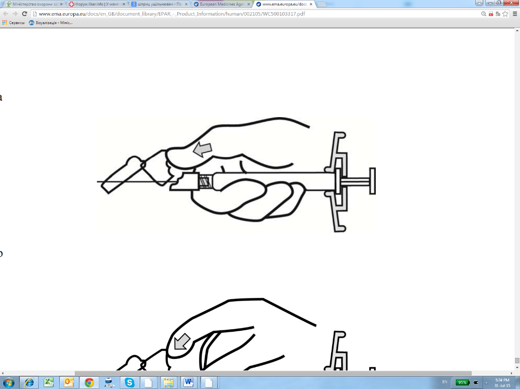 Фото ксепліон®