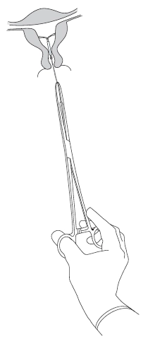 Зображення мірена