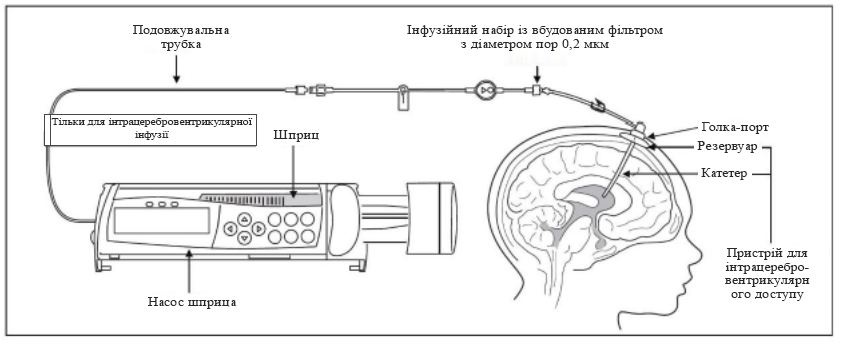 Виробник брінейра