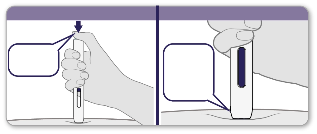 Лікарський засіб енбрел®