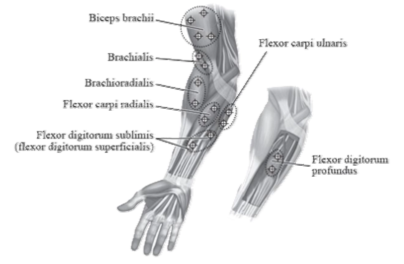 Зображення ботокс® комплекс ботулінічного токсину типу