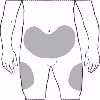 Фото нівестим